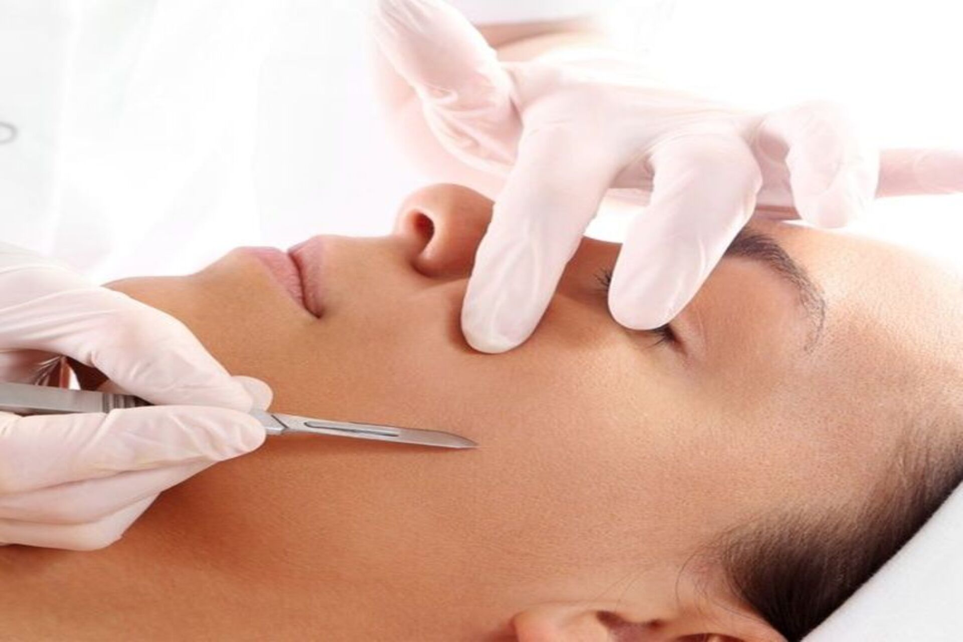 Dermaplaning Facial em duque de caxias rj