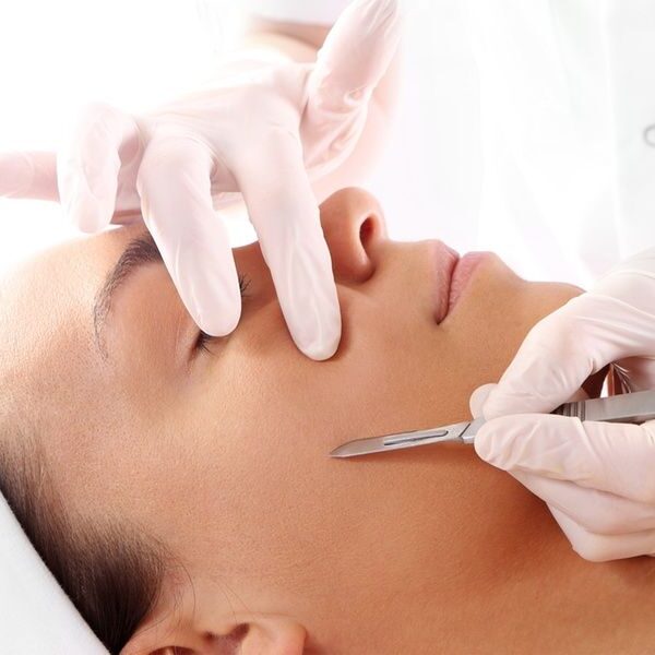 Profissional da Rosa Sperandio promovendo procedimento de Dermaplaning​ em Duque de Caxias no rosto de uma mulher