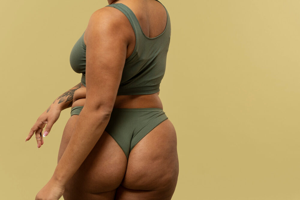 tratamento para celulite rosa sperandio duque de caxias 25 de agosto