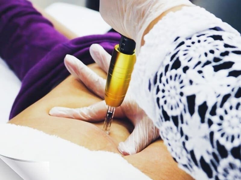 Mulher recebendo tratamento de harmonização facial e corporal em Duque de Caxias, bairro 25 de agosto