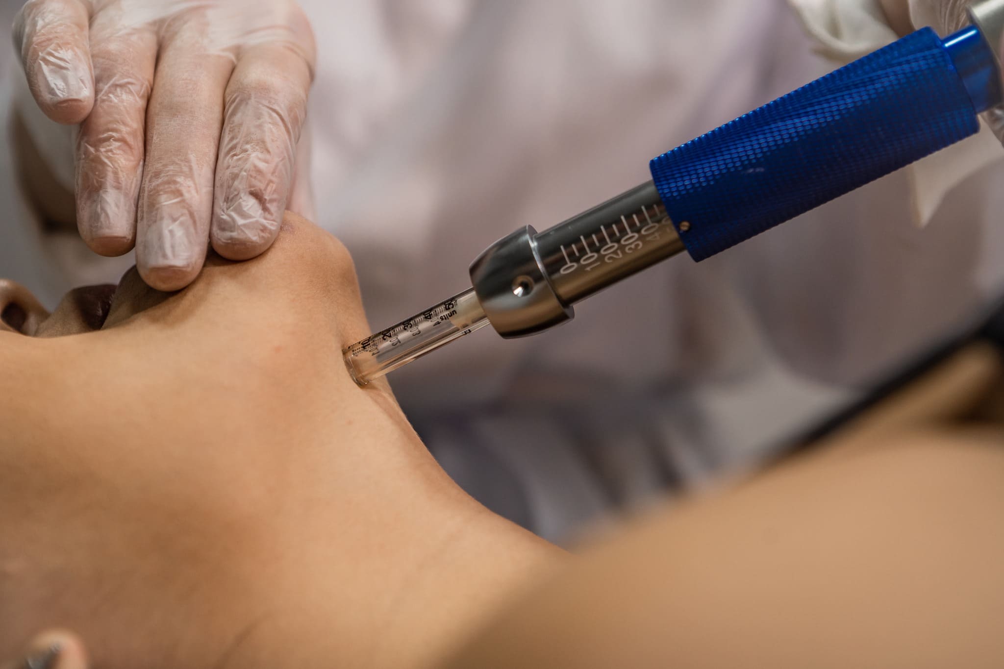 Mulher recebendo tratamento de hormonização facial em duque de caxias em Clínica Estética